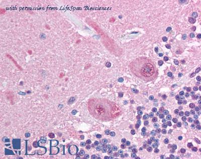 LifeSpan Biosciences LS-B1282 image 1