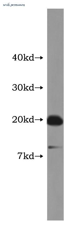 MyBioSource MBS2526125 image 1