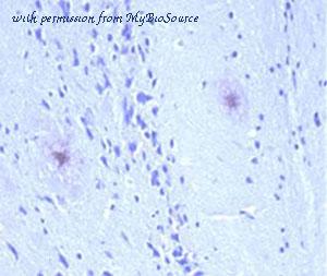 MyBioSource MBS592417 image 1