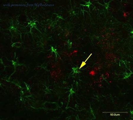 MyBioSource MBS610127 image 1