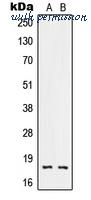MyBioSource MBS820633 image 1