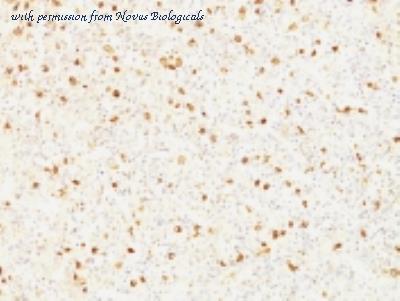 Novus Biologicals NBP2-45130-0.1mg image 1