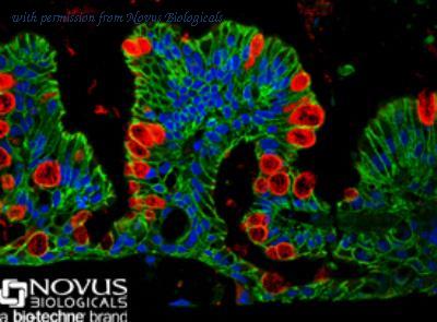 Novus Biologicals NBP1-31231 image 1