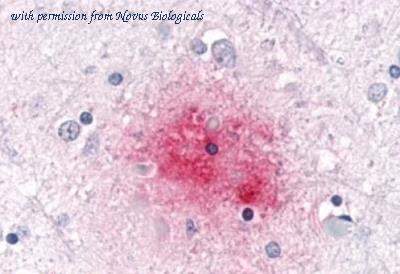 Novus Biologicals NB100-59014 image 1
