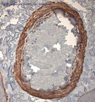 Novus Biologicals NBP1-30670 image 1