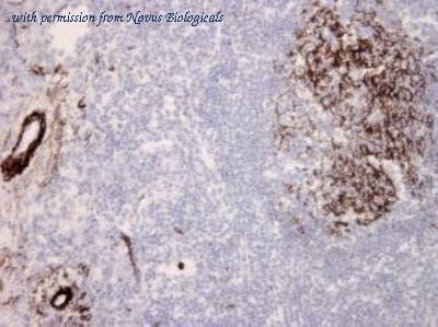 Novus Biologicals NBP1-05120 image 1
