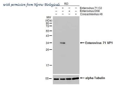 Novus Biologicals NBP3-25451 image 1
