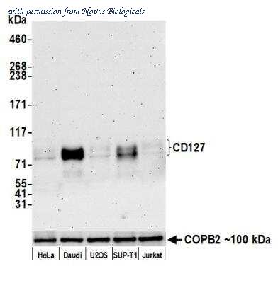 Novus Biologicals NBP3-14749 image 1