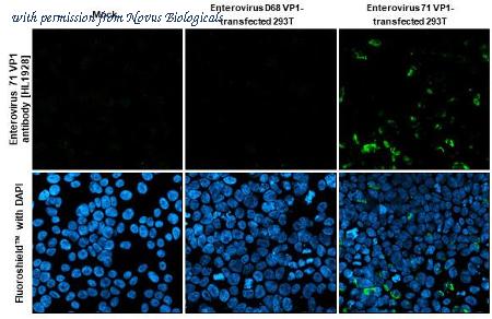 Novus Biologicals NBP3-25450 image 1