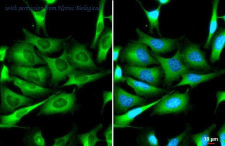 Novus Biologicals NBP3-25766 image 1