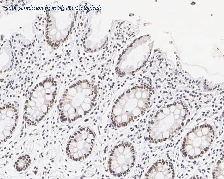Novus Biologicals NBP3-32439 image 1
