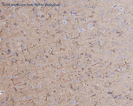 Novus Biologicals NBP3-31998 image 1