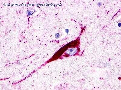 Novus Biologicals NLS516 image 1