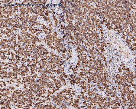 Novus Biologicals NBP3-32073 image 1