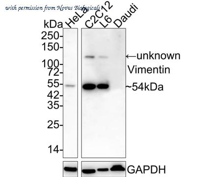 Novus Biologicals NBP3-33092 image 1