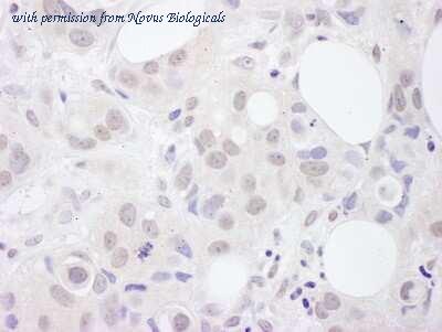 Novus Biologicals NBP2-04140 image 1