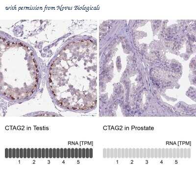 Novus Biologicals NBP2-49659 image 1