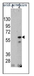 OriGene AM11055PU-N image 1