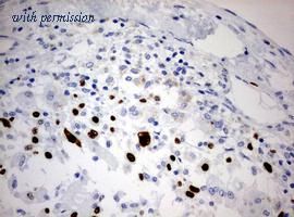 OriGene TA801745BM image 1
