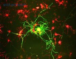 OriGene MO22105-100 image 1