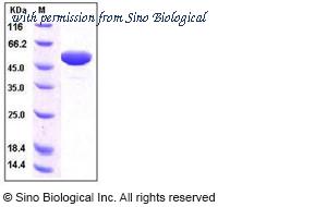 Sino Biological 10686-H02H image 1