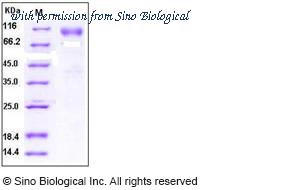 Sino Biological 10175-H02H image 1