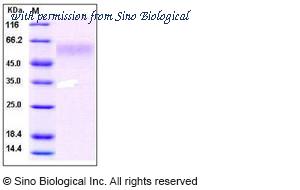 Sino Biological 10175-HCCH image 1