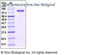 Sino Biological 10149-H02H image 1