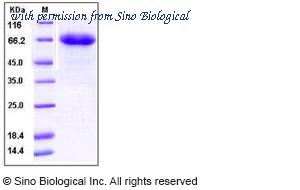 Sino Biological 10235-HCCH image 1
