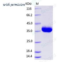 Sino Biological 10345-H08H image 1