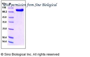 Sino Biological 10156-H02H image 1