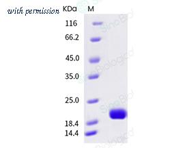 Sino Biological 10395-HNAE image 1