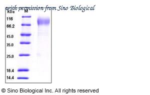 Sino Biological 50146-M08H image 1