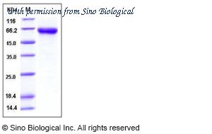Sino Biological 50247-M08H image 1