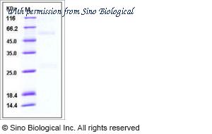 Sino Biological 11059-V08H2 image 1