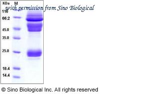 Sino Biological 11060-V08H2 image 1