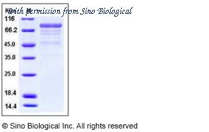 Sino Biological 10317-H08H image 1