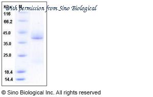 Sino Biological 11150-H08H image 1