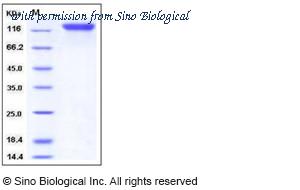 Sino Biological 11226-H08H image 1