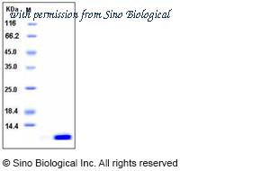 Sino Biological 11143-HNAE image 1