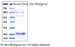 Sino Biological 11368-H07H image 1