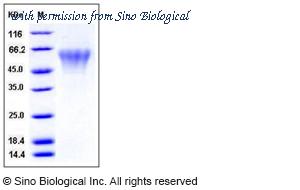 Sino Biological 11655-H08H image 1