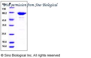 Sino Biological 50268-M08B image 1