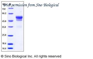 Sino Biological 50520-M02H image 1