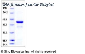 Sino Biological 12045-H07E image 1