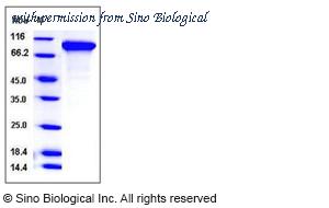 Sino Biological 11617-H08H image 1