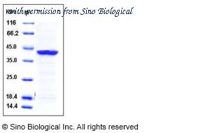 Sino Biological 12076-H07E image 1