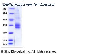 Sino Biological 50623-M08H image 1