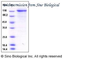 Sino Biological 12213-H20B image 1