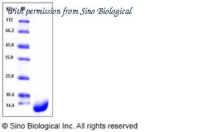 Sino Biological 12557-H07E image 1